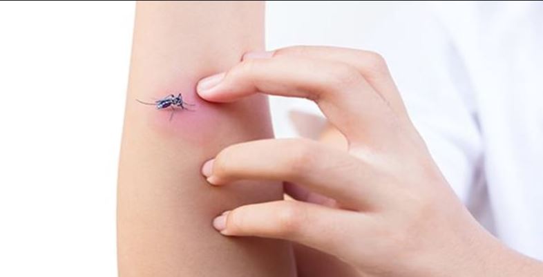 Say Goodbye to Mosquito Bites FOREVER! 7 Super Easy Natural Tricks That Actually Work (No Chemicals Needed!)