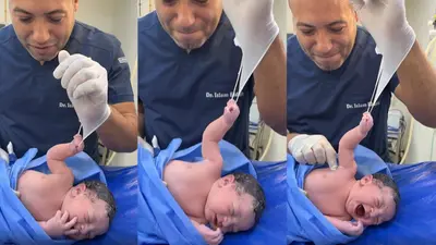 Heart-Melting Moment: Newborn Baby Refuses to Let Go of Doctor's Glove in Viral Video!