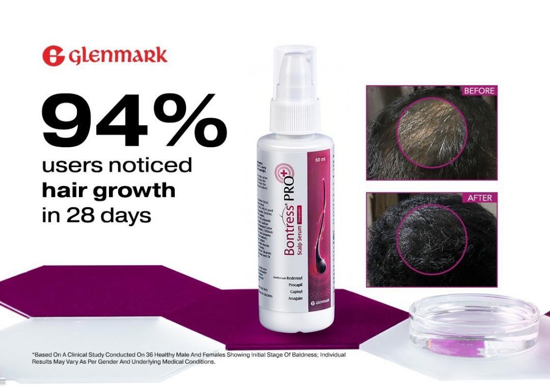 Glenmark Hair Regrowth Breakthrough: Clinical Study Shows 100% Success in Just 84 Days!
