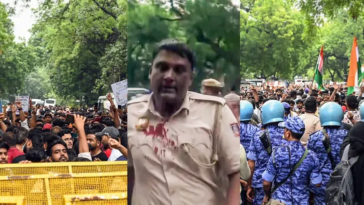 Injured Cop Reveals: Stones Pelted at Us Were Like Railway Track Stones During Violent CJP Protest!