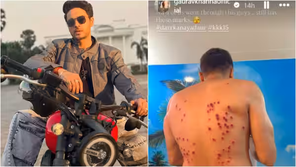 'खतरों के खिलाड़ी' में गौरव खन्ना की पीठ बुरी तरह झुलसी – इसे अब तक का सबसे दर्दनाक अनुभव बताया!