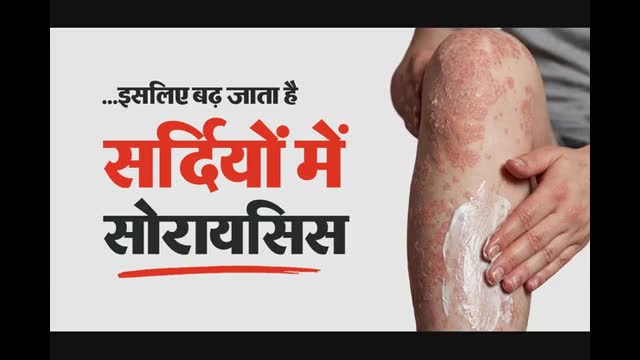 World Psoriasis Day: सर्दियों में सोरायसिस क्यों बढ़ जाता है? डॉक्टर ने बताए इसके 5 बड़े कारण